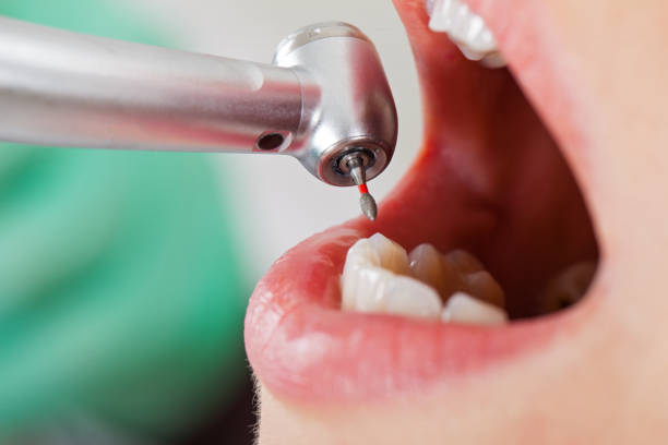 Best Weekend Emergency Dentist in Hidden Meadows, CA